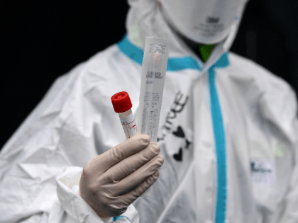 A hospital employee wearing protection mask and gear shows a swab, a cotton wab for taking mouth specimen, used at a temporary emergency structure set up outside the accident and emergency department, where any new arrivals presenting suspect new coronavirus symptoms will be tested, at the Brescia hospital, Lombardy, on …