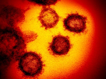 FILE - This undated electron microscope image made available by the U.S. National Institutes of Health in February 2020 shows the Novel Coronavirus SARS-CoV-2. Also known as 2019-nCoV, the virus causes COVID-19. The sample was isolated from a patient in the U.S. On Friday, Feb. 21, 2020, The Associated Press …
