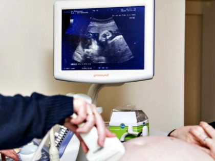 In an illustration photo, a doctor performs an ultrasound on a pregnant woman during her v