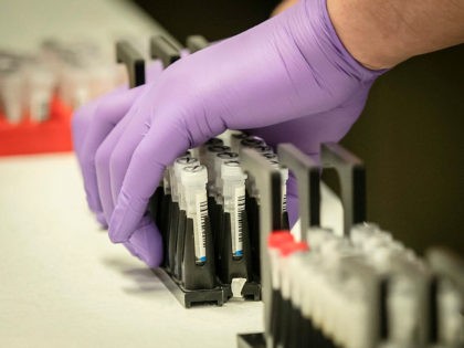 Samples are tested for respiratory viruses, which procedure will be used to test the novel coronavirus COVID-19, during a visit by Britain's Chancellor of the Exchequer Rishi Sunak to the pathology labs at Leeds General Infirmary to highlight the record infrastructure spend after yesterday's budget, in Leeds, Yorkshire on March …