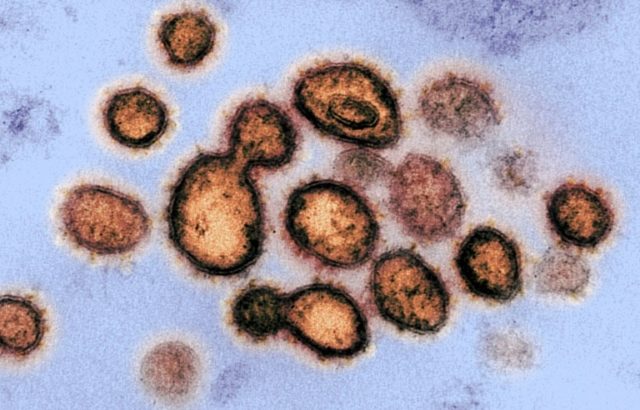 Viruses: ancient, tiny, amazing