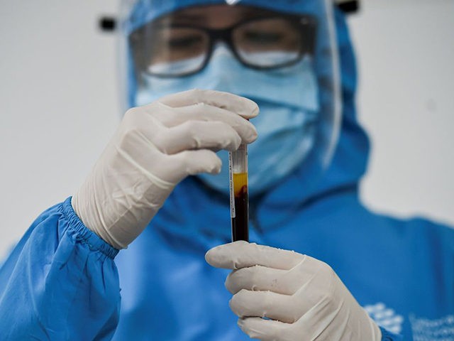 A health worker manipulates a blood sample at the COVID-19 area of the Microanalisis Integ