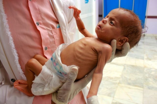 © AFP ESSA AHMED
