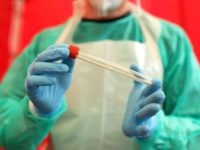 Lab: Contaminated Samples Resulted in Dozens of False Positive NFL Covid Tests