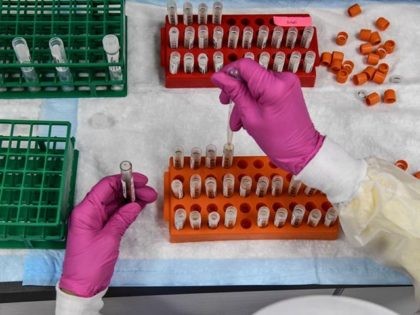 A lab technician sorts blood samples for COVID-19 vaccination study at the Research Centers of America in Hollywood, Florida on August 13, 2020. (Photo by CHANDAN KHANNA / AFP) (Photo by CHANDAN KHANNA/AFP via Getty Images)