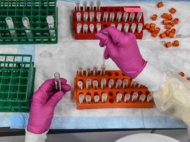 A lab technician sorts blood samples for COVID-19 vaccination study at the Research Center