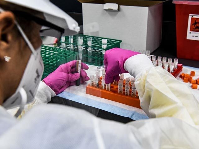 A lab technician sorts blood samples inside a lab for a COVID-19 vaccine study at the Rese