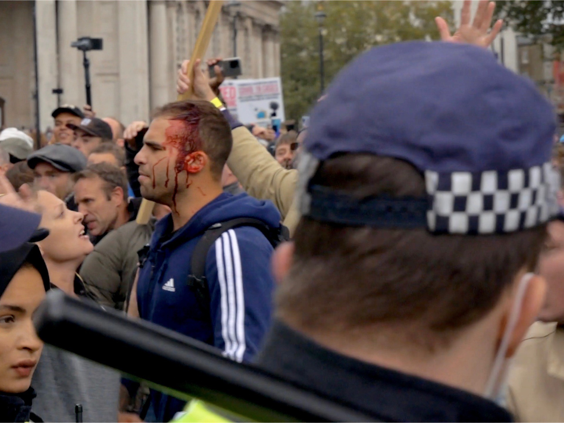 A man is seen with a bloody face after clashing with police at an anti-lockdown Protest in Trafalgar Square, London on September 26th 2020. Kurt Zindulka, Breitbart News