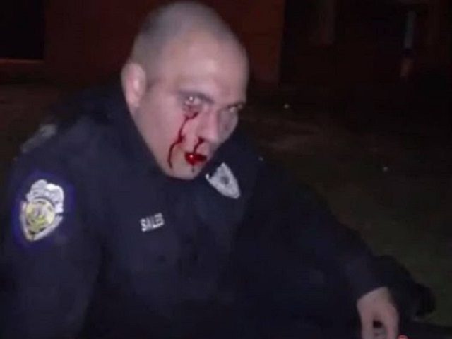 Rowland Police Officer Michael Sale is beaten during an attempted arrest. (Photo: Facebook/Sheriff Burnis Wilkins)