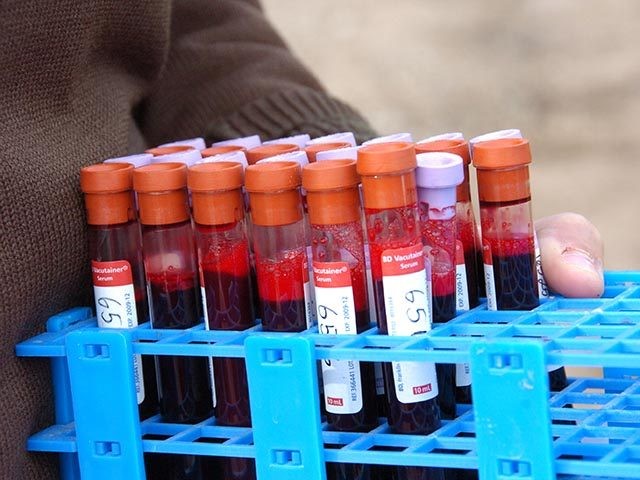 Blood samples are collected from Yellowstone National Park bison on Wednesday, March 9, 2016 in Yellowstone National Park, Mont. Many park bison carry the disease brucellosis, prompting the park to capture and kill the animals when they attempt to migrate into Montana to prevent transmissions to livestock. (AP Photo/Matthew Brown)