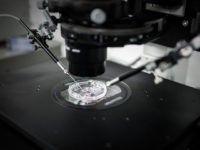 Woman Sues Fertility Doctor for Using His Own Sperm to Impregnate Her