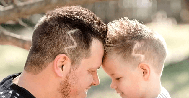 Father Gets Lightning Bolt Haircut To Match His Son s Scars
