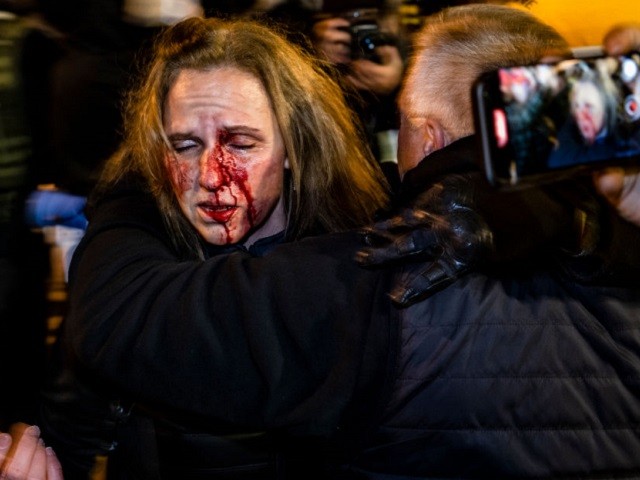 A woman is held by her husband after being struck in the face when police attempted to push back a group of pro-Trump protesters that tried to push through their lines into Black Lives Matter Plaza on January 5, 2021 in Washington, DC. Today's rally kicks off two days of pro-Trump events fueled by President Trump's continued claims of election fraud and a last ditch effort to overturn the results before Congress finalizes them on January 6. (Photo by Samuel Corum/Getty Images)