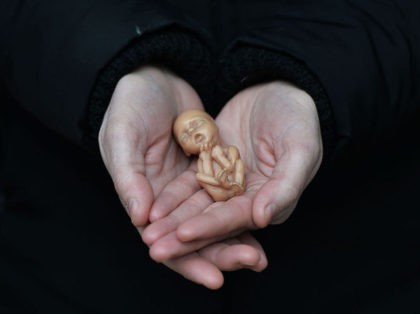BELFAST, NORTHERN IRELAND - APRIL 07: A Pro Life campaigner displays a plastic doll representing a 12 week old foetus as she stands outside the Marie Stopes Clinic on April 7, 2016 in Belfast, Northern Ireland. The anit abortion supporters have protested outside the clinic where women can go for …