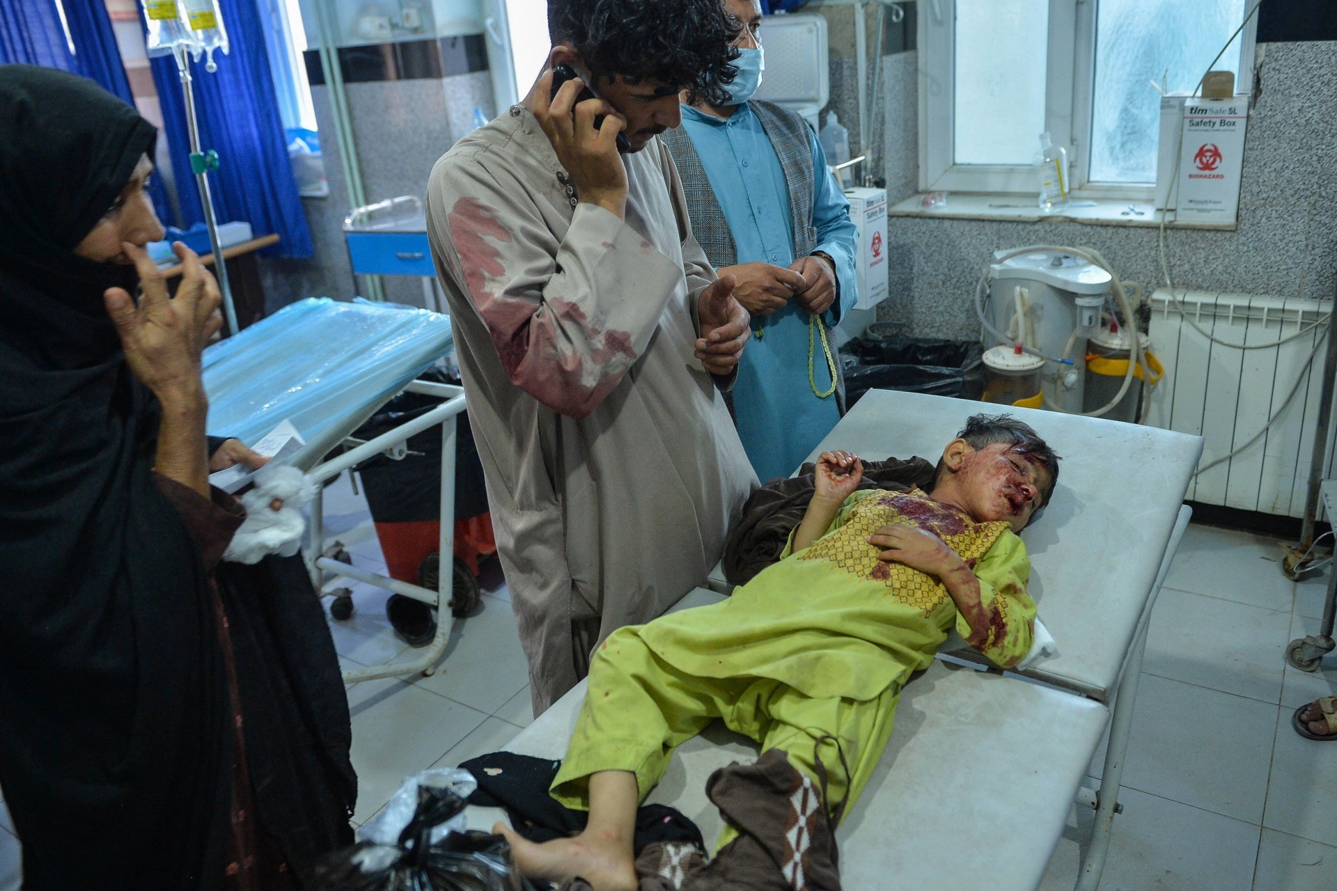 EDITORS NOTE: Graphic content / A child lies on a bed awaiting treatment at a ward of the Central hospital in Herat on August 1, 2021 after he was injured during the skirmishes between Afghan forces and Taliban. (Photo by HOSHANG HASHIMI / AFP) (Photo by HOSHANG HASHIMI/AFP via Getty Images)