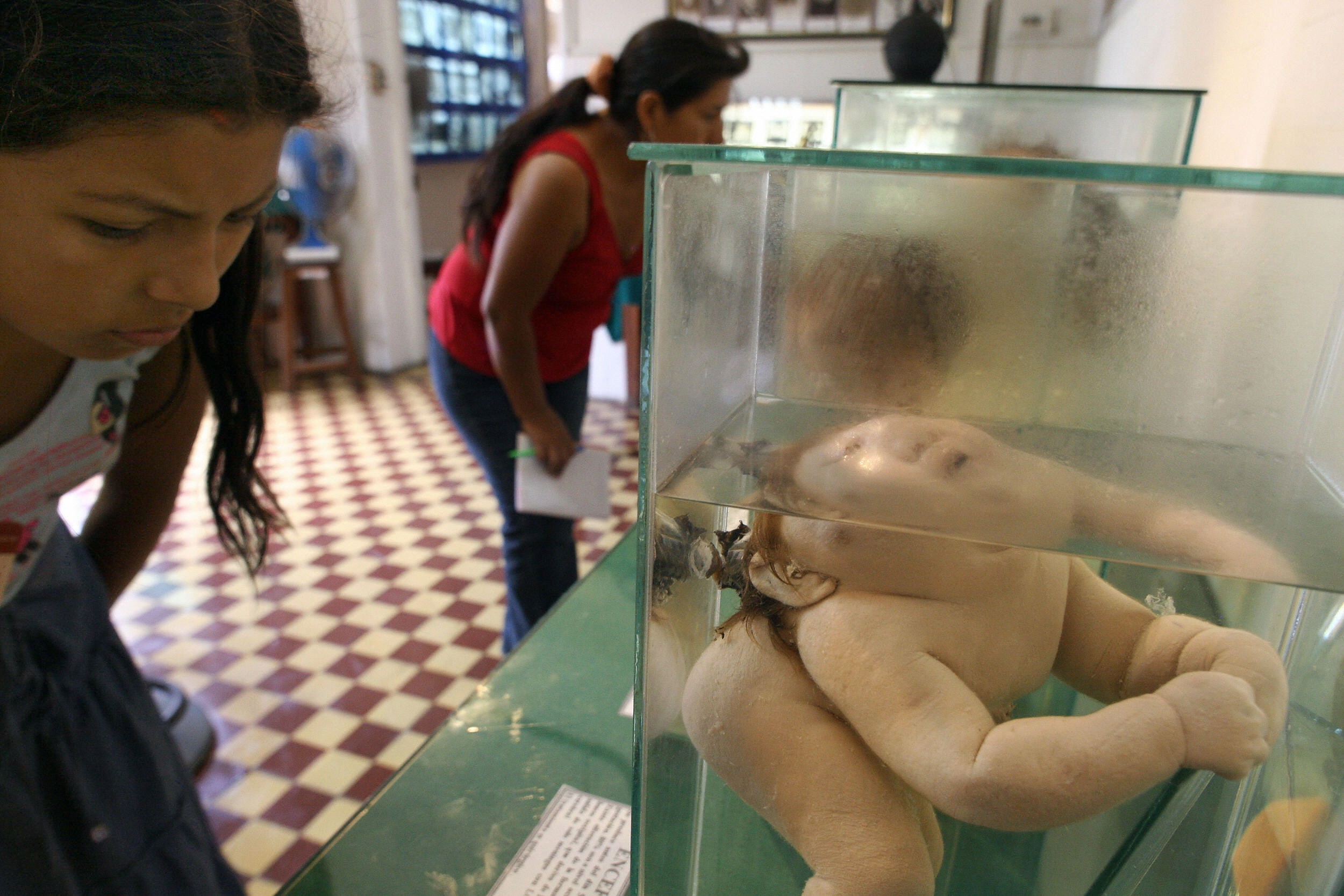 Lima, PERU: Visitors look at a human foetuses on display at the Museum of the Brain 03 March, 2005 in Lima. The museum's collection, recently open to the public, has 2,841 parts of human brains affected by diverse pathologies and are meant for analysis and study of the organ. AFP PHOTO/EITAN ABRAMOVICH (Photo credit should read EITAN ABRAMOVICH/AFP via Getty Images)