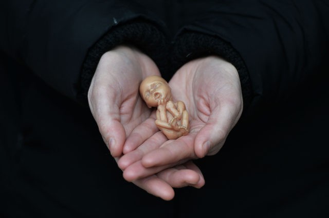 BELFAST, NORTHERN IRELAND - APRIL 07: A Pro Life campaigner displays a plastic doll representing a 12 week old foetus as she stands outside the Marie Stopes Clinic on April 7, 2016 in Belfast, Northern Ireland. The anit abortion supporters have protested outside the clinic where women can go for …