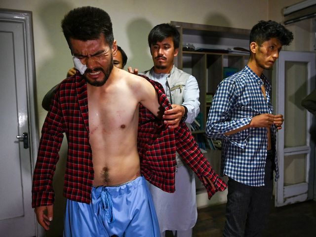 In this picture taken on September 8, 2021, Afghan newspaper Etilaat Roz journalist Nematullah Naqdi (L) reacts as his colleagues help him wear a shirt in their office in Kabul after being released from Taliban custody. (Wakil Kohsar/AFP via Getty Images)