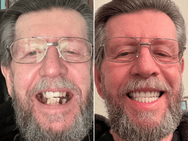 WATCH: Veteran Receives Long-Awaited Dental Care Thanks to Nonprofit - Vimarsana News