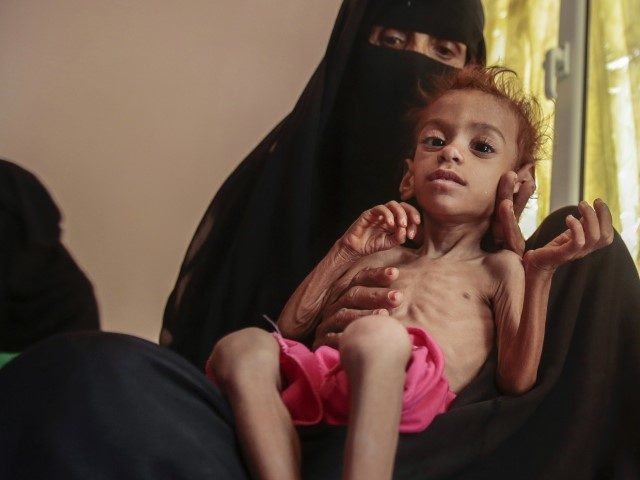 FILE - In this Oct. 1, 2018 file photo, a woman holds a malnourished boy at the Aslam Heal