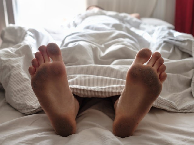 Dirty bare feet of a sleeping person showing out of the blanket on a bed. Hygiene or unsan