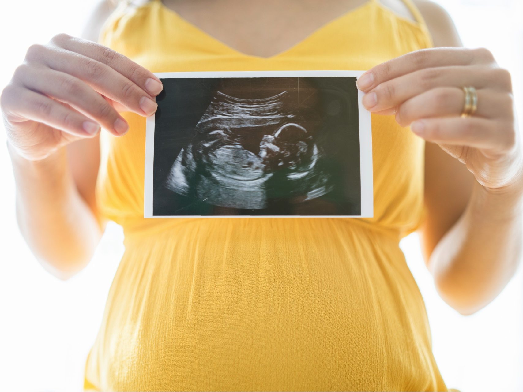 Swedish Parties Want to Make Abortion a Constitutional Right - Vimarsana News