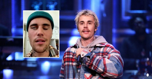 Justin Bieber canceled the show after paralyzing half of his face due to Ramsay Hunt Syndrome.