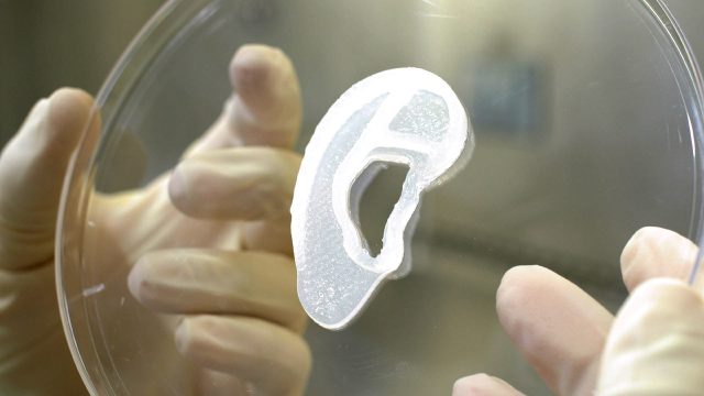 This undated image courtesy of 3D Bio Therapeutics, shows a 3D print of an ear lobe