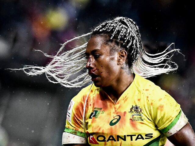 SYDNEY, AUSTRALIA - FEBRUARY 02: Ellia Green of Australia is seen with blood on her face after a collision during the 2020 Sydney Sevens Women's Bronze Medal match between Australia and France at Bankwest Stadium on February 02, 2020 in Sydney, Australia. (Photo by Bradley Kanaris/Getty Images)