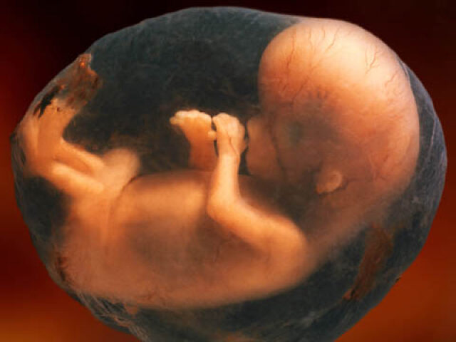 Unborn child in the womb.