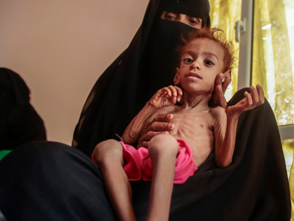 In this Oct. 1, 2018 file photo, a woman holds a malnourished boy at the Aslam Health Center, in Hajjah, Yemen. On Sunday, Feb. 28, 2021, the U.N. Office for the Coordination of Humanitarian Affairs warned that more than 16 million people in Yemen would go hungry this year, with …
