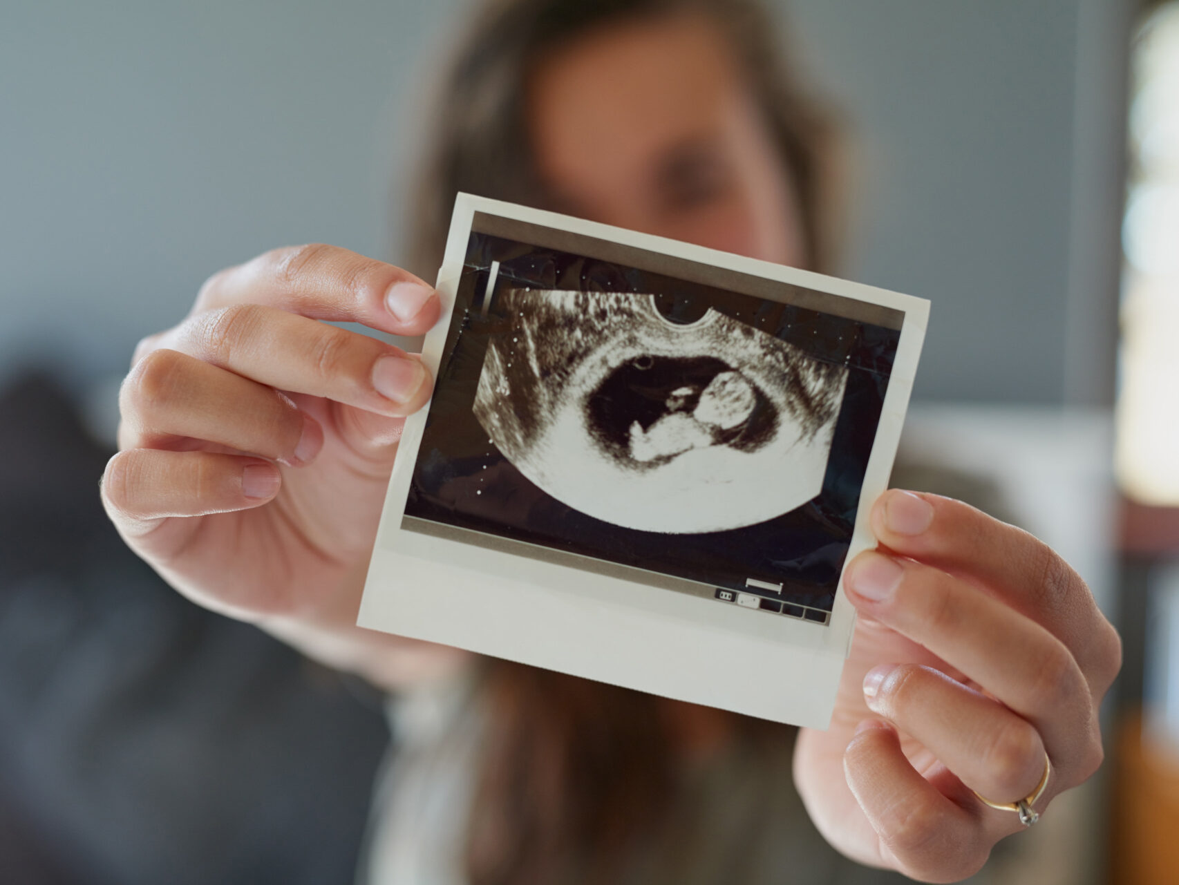 Hungary Heartbeat Law: Mother Must Hear Child's Heart Before Abortion - Vimarsana News