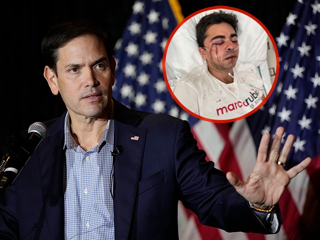 Marco Rubio Volunteer Viciously Attacked By Assailants Who Said Republicans Werent Allowed In