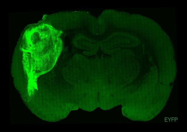 The brain of a rat in which a fluorescent protein has been used to highlight transplanted