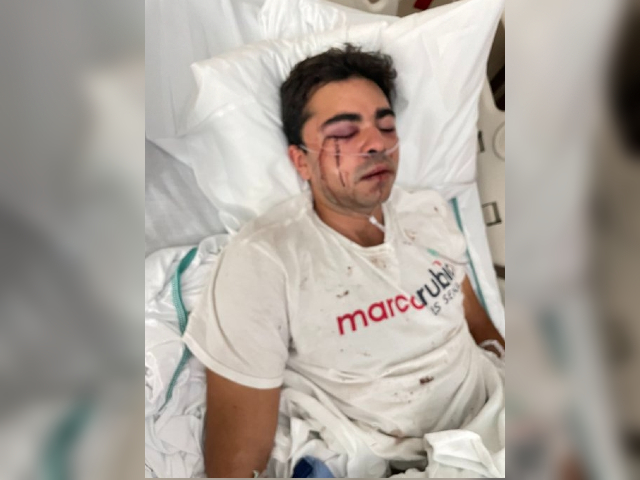Political Violence Rages Against GOP Candidates, Staffers, Volunteers - Vimarsana News