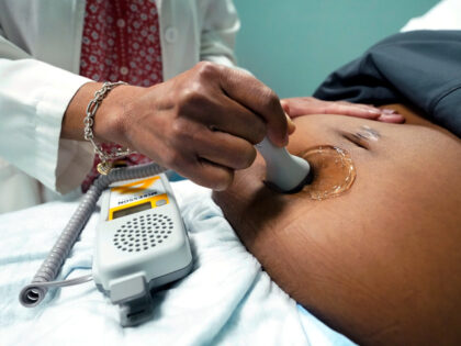 FILE - A doctor uses a hand-held Doppler probe on a pregnant woman to measure the heartbea