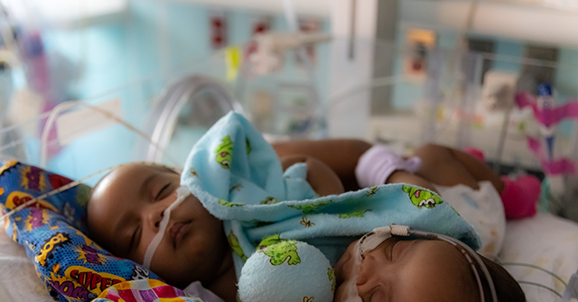 VIDEO: Doctors Celebrate First Conjoined Twins Separated at Texas ...