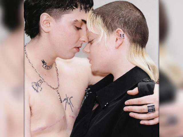 Burberry Features Transgender Model with Visible Mastectomy Scars in Valentine's Day Campaign - Vimarsana News