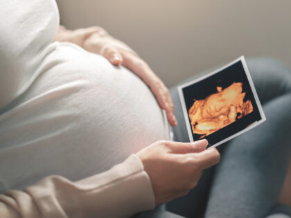 Asian pregnant woman holding ultrasound 4d scan image, Expectation of a child and Maternit