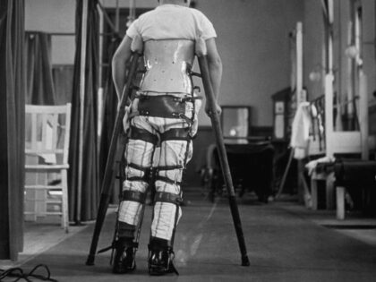 1947: A child suffering from Infantile Paralysis learning to walk with the aid of a special support, at Queen Mary's Hospital, London. (Photo by George Konig/Keystone Features/Getty Images)