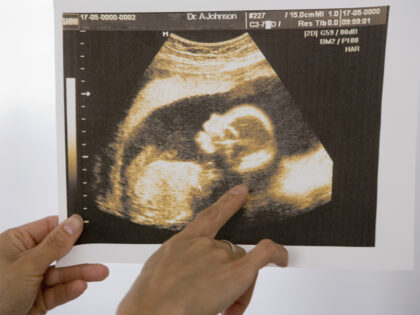 Woman pointing at sonogram