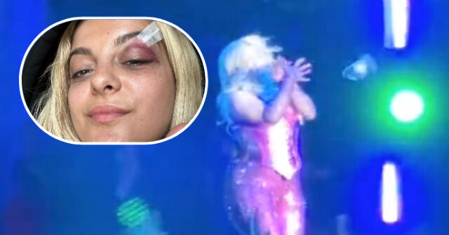 Watch: Pop Star Bebe Rexha Hit in the Face with Phone During Performance