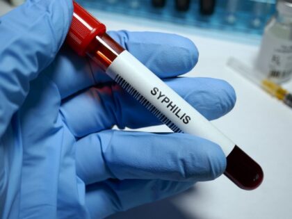 Syphilis - sexually transmitted disease blood test and treatment