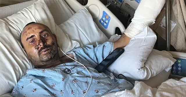 VIDEO: California Gardener's Hand Blown Off by Suspected Firework