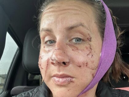 Montana woman survives otter attack