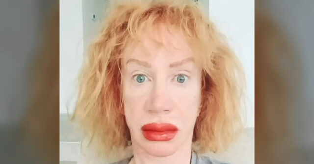 Kathy Griffin Gets Her Lips Tattooed, Shares Swollen 'Before' Picture