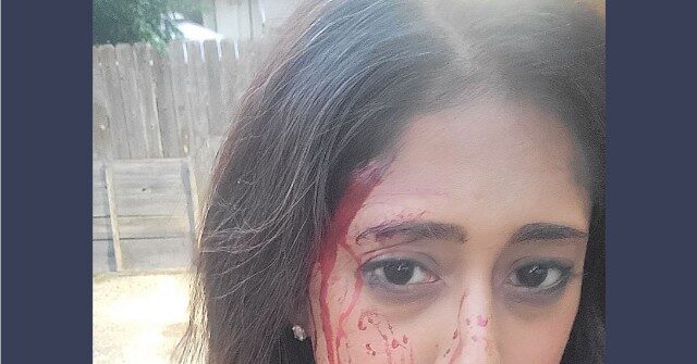 PHOTO: MN Democrat Who Vowed to Dismantle Police Bloodied in Carjacking
