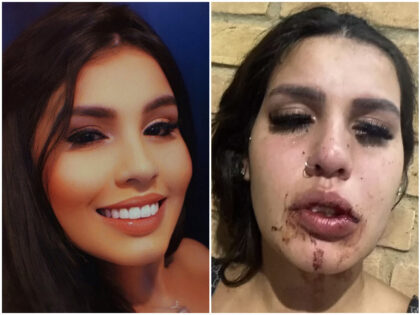 Brazilian Influencer, 19, Accuses Fellow Influencers of Drugging, Raping Her at Party