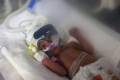 Palestinian baby Sabreen al-Ruh al-Sheikh, delivered preterm by caesarian section minutes
