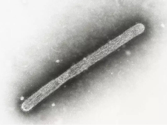 This 2005 electron microscope image shows an avian influenza A H5N1 virion. On Wednesday,